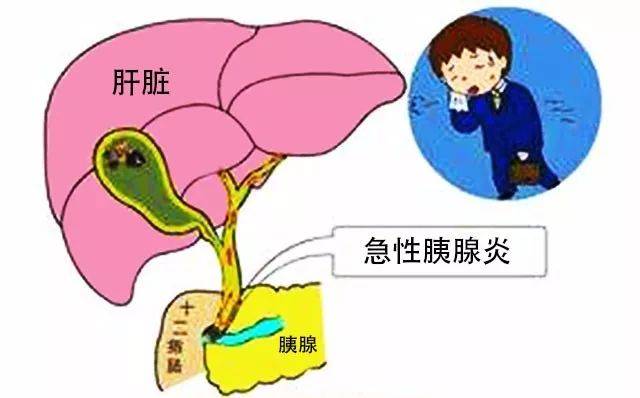 胆囊去留两难全？成都胆结石医院何明刚主任表示：该保则保，当切则切！(图2)