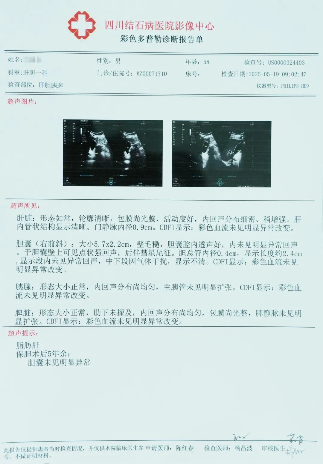 对话保胆者：吃鸡内金化结石？他亲历“结石反而越吃越大”【四川结石病专科医院】】(图1)