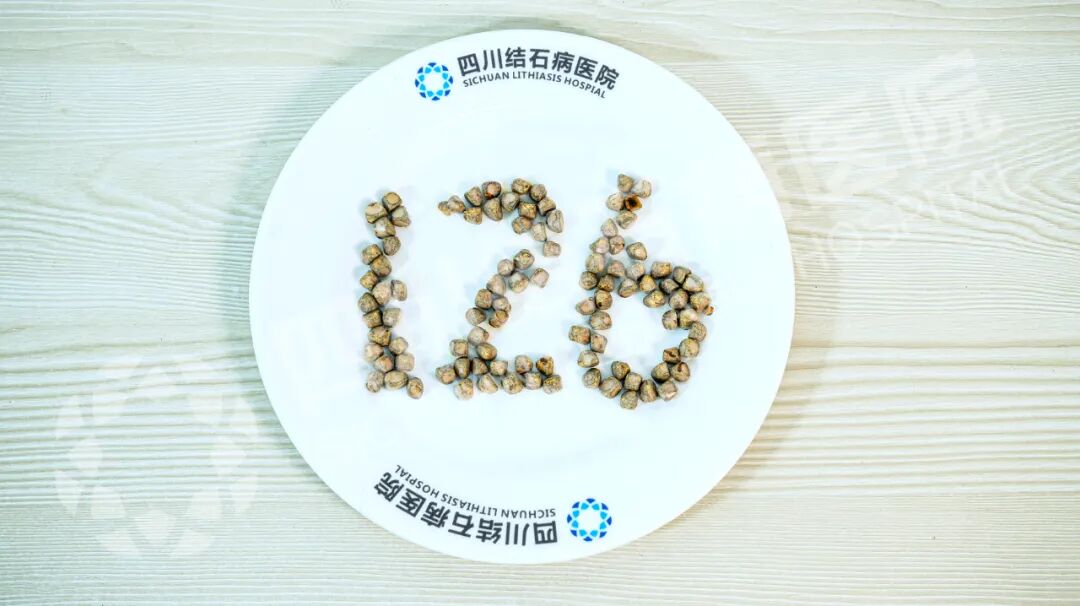 126颗结石藏胆囊!杭州男子赴川保胆手术登热搜,这些风险别忽视(图2) 126颗结石藏胆囊!杭州男子赴川保胆手术登热搜,这些风险别忽视(图2)